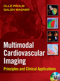 Multimodal Cardiovascular Imaging: Principles and Clinical Applications (Original PDF from Publisher)