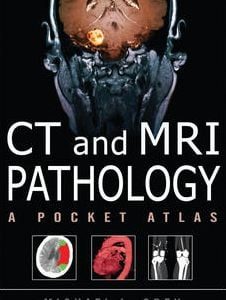 CT & MRI Pathology: A Pocket Atlas, Second Edition (ORIGINAL PDF from Publisher)