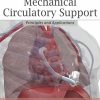 Mechanical Circulatory Support: Principles and Applications (Original PDF from Publisher)