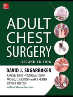 Adult Chest Surgery, 2nd Edition (ORIGINAL PDF from Publisher)