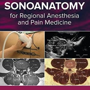 Atlas of Sonoanatomy for Regional Anesthesia and Pain Medicine (EPUB)