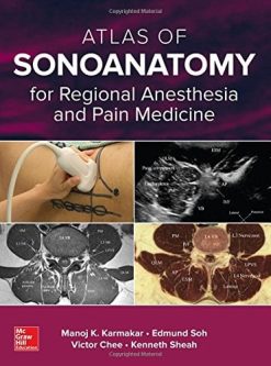Atlas of Sonoanatomy for Regional Anesthesia and Pain Medicine (ORIGINAL PDF from Publisher)