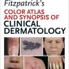 Fitzpatrick’s Color Atlas and Synopsis of Clinical Dermatology, 7th Edition (epub)