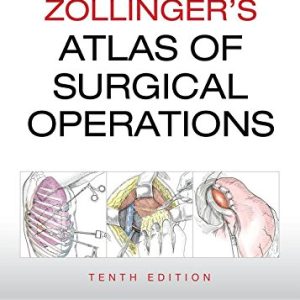 Zollinger’s Atlas of Surgical Operations, Tenth Edition (ORIGINAL PDF from Publisher)