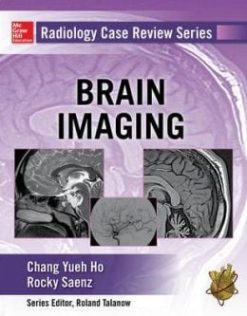 Radiology Case Review Series: Brain Imaging (ORIGINAL PDF from Publisher)