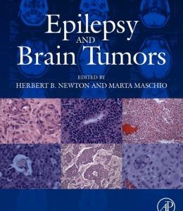 Epilepsy and Brain Tumors