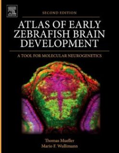 Atlas of Early Zebrafish Brain Development: A Tool for Molecular Neurogenetics