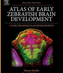 Atlas of Early Zebrafish Brain Development: A Tool for Molecular Neurogenetics