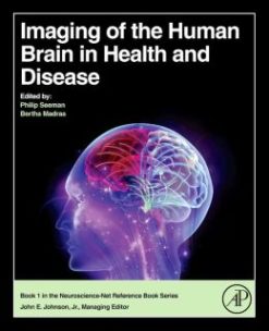 Imaging of the Human Brain in Health and Disease (ORIGINAL PDF from Publisher)
