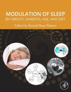 Modulation of Sleep by Obesity, Diabetes, Age, and Diet (ORIGINAL PDF from Publisher)