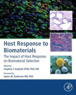 Host Response to Biomaterials: The Impact of Host Response on Biomaterial Selection