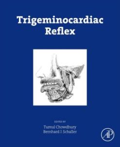 Trigeminocardiac Reflex