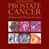 Prostate Cancer: Science and Clinical Practice, 2nd Edition