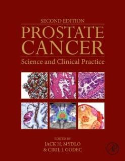Prostate Cancer: Science and Clinical Practice, 2nd Edition