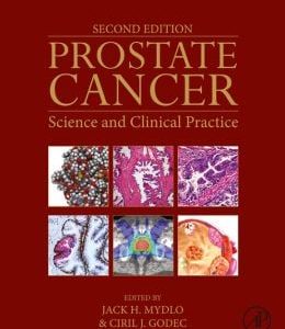Prostate Cancer: Science and Clinical Practice, 2nd Edition