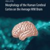 Atlas of the Morphology of the Human Cerebral Cortex on the Average MNI Brain (EPUB)