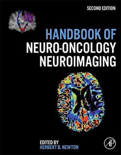 Handbook of Neuro-Oncology Neuroimaging, 2nd Edition (Original PDF from Publisher)