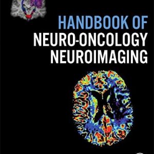 Handbook of Neuro-Oncology Neuroimaging, 2nd Edition (Original PDF from Publisher)