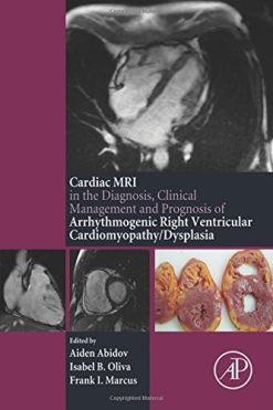 The Cardiac MRI in Diagnosis, Clinical Management, and Prognosis of Arrhythmogenic Right Ventricular Cardiomyopathy/Dysplasia