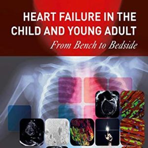 Heart Failure in the Child and Young Adult: From Bench to Bedside (Original PDF from Publisher)