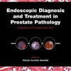 Endoscopic Diagnosis and Treatment in Prostate Pathology: Handbook of Endourology