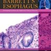Barrett’s Esophagus: Emerging Evidence for Improved Clinical Practice