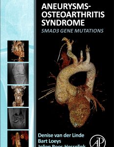 Aneurysms-Osteoarthritis Syndrome: SMAD3 Gene Mutations (Original PDF from Publisher)