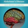 Genes, Environment and Alzheimer’s Disease