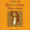 Atlas of Mycobacterium Tuberculosis (PDF)
