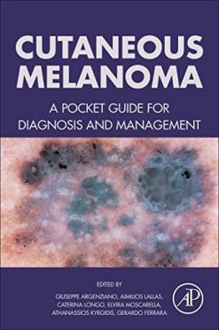 Cutaneous Melanoma: A Pocket Guide for Diagnosis and Management (PDF)