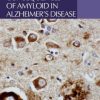 Intracellular Consequences of Amyloid in Alzheimer’s Disease