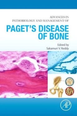 Advances in Pathobiology and Management of Paget’s Disease of Bone
