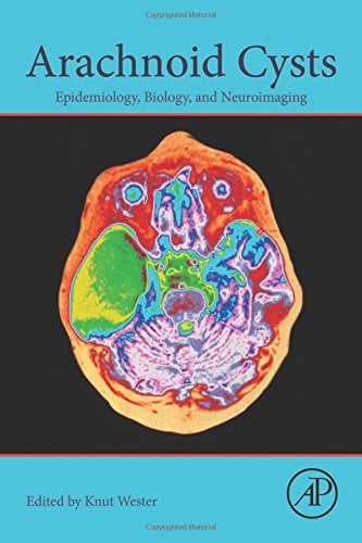 Arachnoid Cysts: Epidemiology, Biology, and Neuroimaging (PDF)