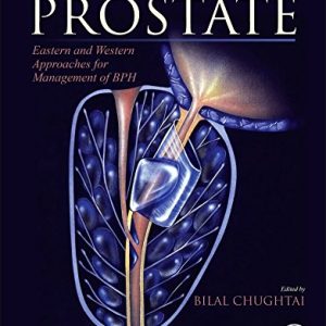 A Comprehensive Guide to the Prostate: Eastern and Western Approaches for Management of BPH (PDF)