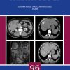 Echinococcus and Echinococcosis, Part B (PDF)