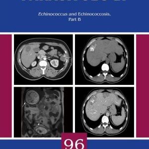 Echinococcus and Echinococcosis, Part B (PDF)