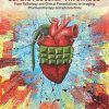 Cardiovascular Thrombus: From Pathology and Clinical Presentations to Imaging, Pharmacotherapy and Interventions (PDF)
