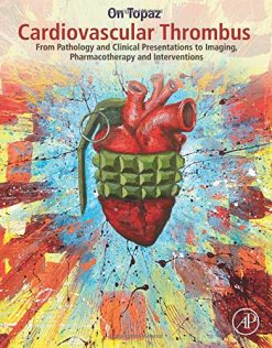 Cardiovascular Thrombus: From Pathology and Clinical Presentations to Imaging, Pharmacotherapy and Interventions (PDF)