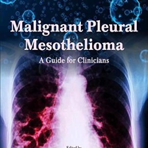 Malignant Pleural Mesothelioma: A Guide for Clinicians (Original PDF from Publisher)