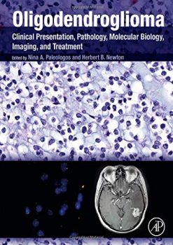 Oligodendroglioma: Clinical Presentation, Pathology, Molecular Biology, Imaging, and Treatment (Original PDF from Publisher)