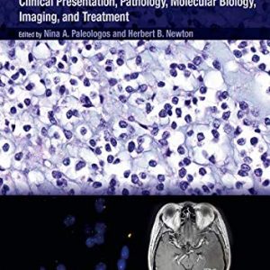 Oligodendroglioma: Clinical Presentation, Pathology, Molecular Biology, Imaging, and Treatment (Original PDF from Publisher)
