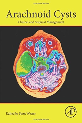 Arachnoid Cysts: Clinical and Surgical Management (PDF)