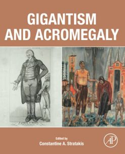 Gigantism and Acromegaly: Genetics, Diagnosis, and Treatment (Original PDF from Publisher)