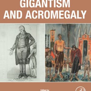 Gigantism and Acromegaly: Genetics, Diagnosis, and Treatment (Original PDF from Publisher)
