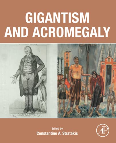 Gigantism and Acromegaly: Genetics, Diagnosis, and Treatment (Original PDF from Publisher)
