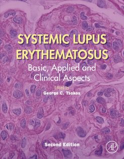 Systemic Lupus Erythematosus: Basic, Applied and Clinical Aspects, 2nd Edition (EPUB)