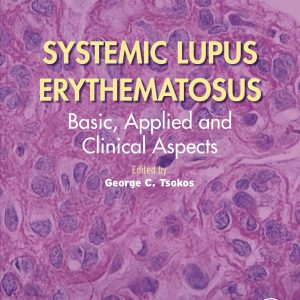 Systemic Lupus Erythematosus: Basic, Applied and Clinical Aspects, 2nd Edition (EPUB)
