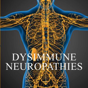 Dysimmune Neuropathies (Original PDF from Publisher)