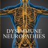 Dysimmune Neuropathies (EPUB)