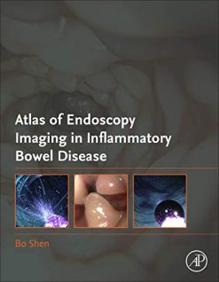 Atlas of Endoscopy Imaging in Inflammatory Bowel Disease (Original PDF from Publisher)